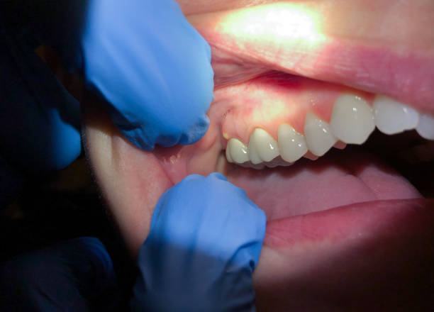 Best Pediatric Emergency Dentist in Lusk, WY