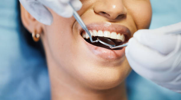 Best Emergency Treatment for Dental Infections or Abscesses in Lusk, WY